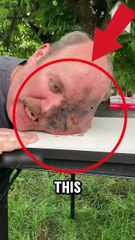 What’s Happening to His Face ! 😱