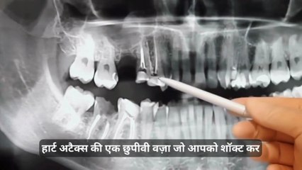 Hidden Causes of Heart Attack you didn't know