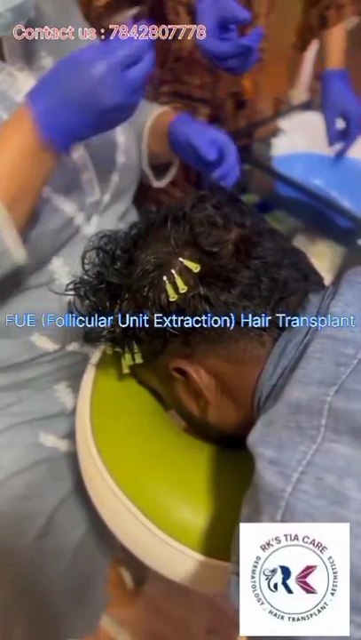 FUE Hair Transplant Explained | Follicular Unit Extraction Treatment by TiaCare.in