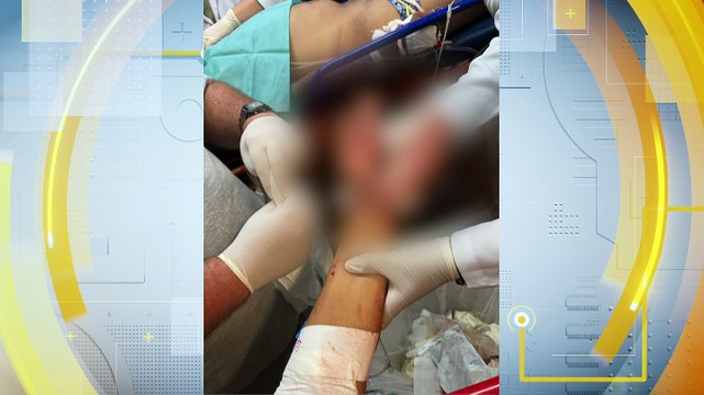 Violência Doméstica Extrema: Mulher é Violentamente Atacada com Facão pelo Companheiro e Corre Risco de Ficar Paralisada