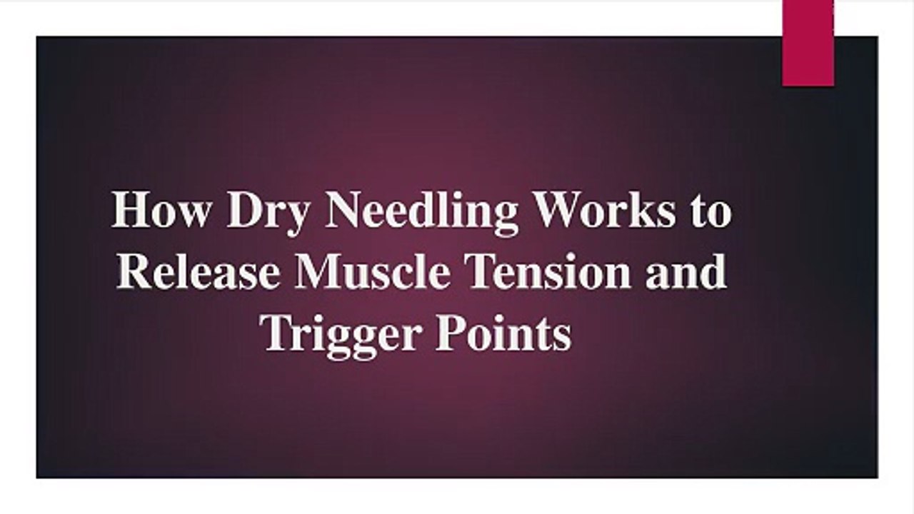 How Dry Needling Works to Release Muscle Tension