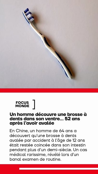 🚨🦷🇨🇳 insolite | Il consulte pour une gêne au ventre… et les médecins découvrent une brosse à dents avalée il y a 52 ANS 😱 À 64 ans, ce patient chinois n’avait aucun symptôme grave. L’histoire défie la logique médicale 🧠