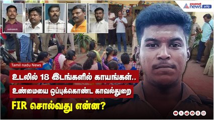 அஜித்குமாருக்கு 18 காயங்கள்: காவல்துறை FIR மற்றும் உண்மை என்ன? 🕵️‍♂️