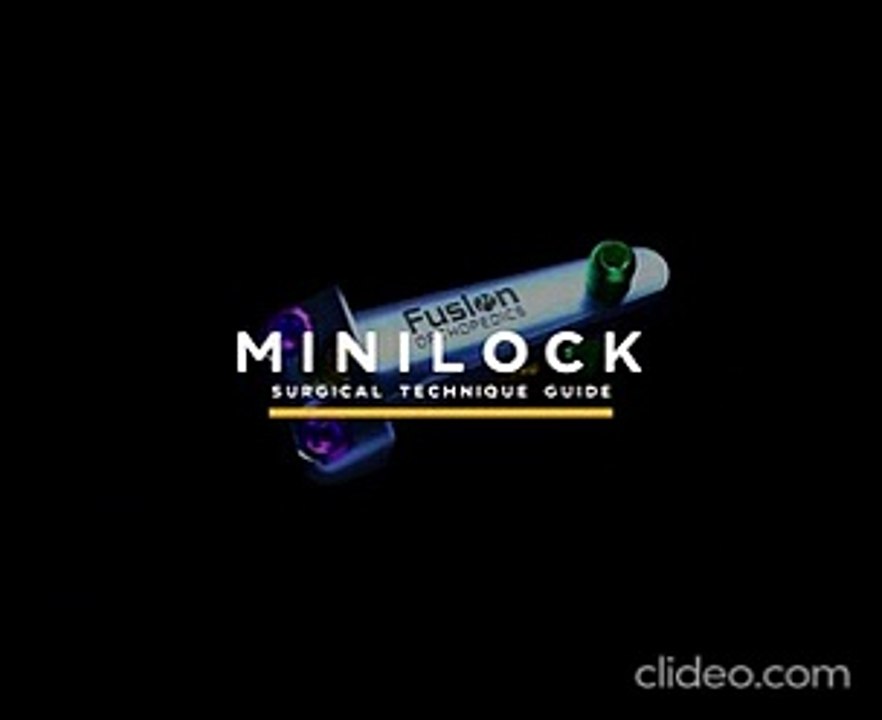 Best lapilock service provider in USA