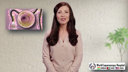 Paving the Way: Optimal Bowel Preparation for a Smooth Laparoscopic Surgery