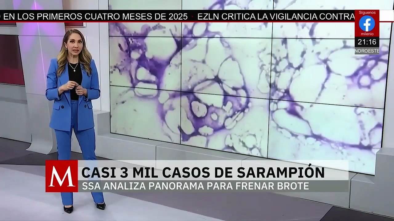 Autoridades en alerta por brote de sarampión co...