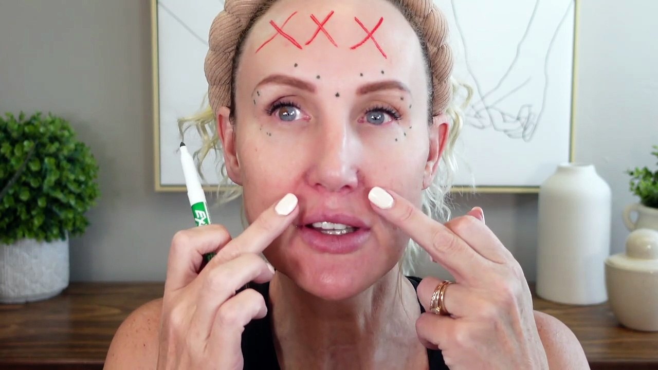 Should Your Botox Change as You Age? Botox Face Lifting Over 40