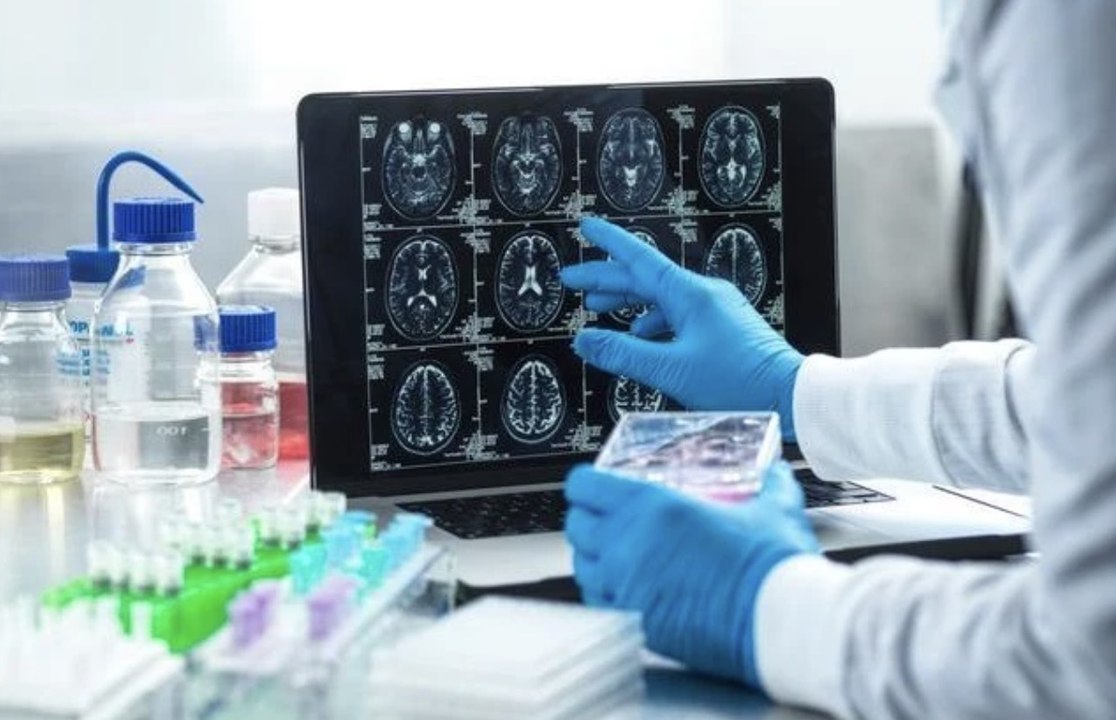 Un IRM puissant livre des images d'une précision inédite du cerveau de l'enfant
