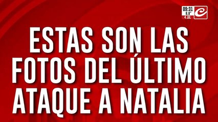 Violencia de género: estas son las fotos que evidencian el brutal ataque a Natalia