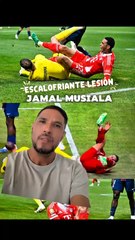 JamalMusiala sufre una escalofriante lesión