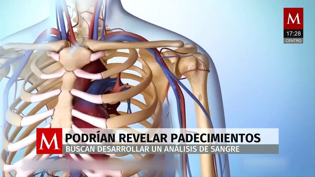 Análisis de sangre podría revelar padecimientos como la leucemia