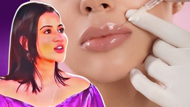 Urfi Javed Lip Filler: The Traitors Winner ने 18 की उम्र में कराई Cosmetic Surgery, कितनी Safe...