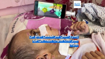 جسد صغير مثقل بالحرب.. طفل مصاب بتلف دماغي في غزة يُصارع للبقاء