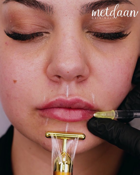Discovering the magic of eyelash extensions & lip filler 👁️💋