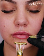 Discovering the magic of eyelash extensions & lip filler 👁️💋