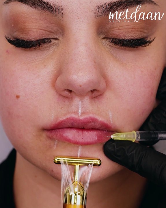 Discovering the magic of eyelash extensions & lip filler 👁️💋