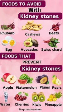 Foods that prevent kidney stones, and some foods to avoid with kidney stones..