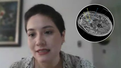 Innovadora cirugía que ayudaría a combatir la depresión fue practicada en Santander