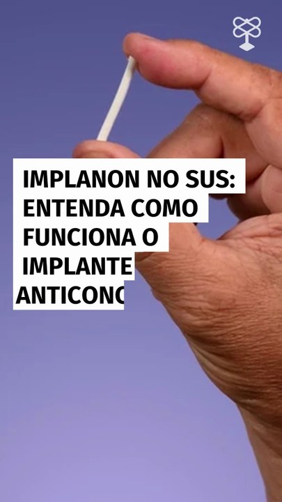 Implanon será oferecido pelo SUS: veja como funciona o anticoncepcional gratuito