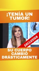 Paty Navidad revela su lucha contra una enfermedad hormonal: Prolactinoma