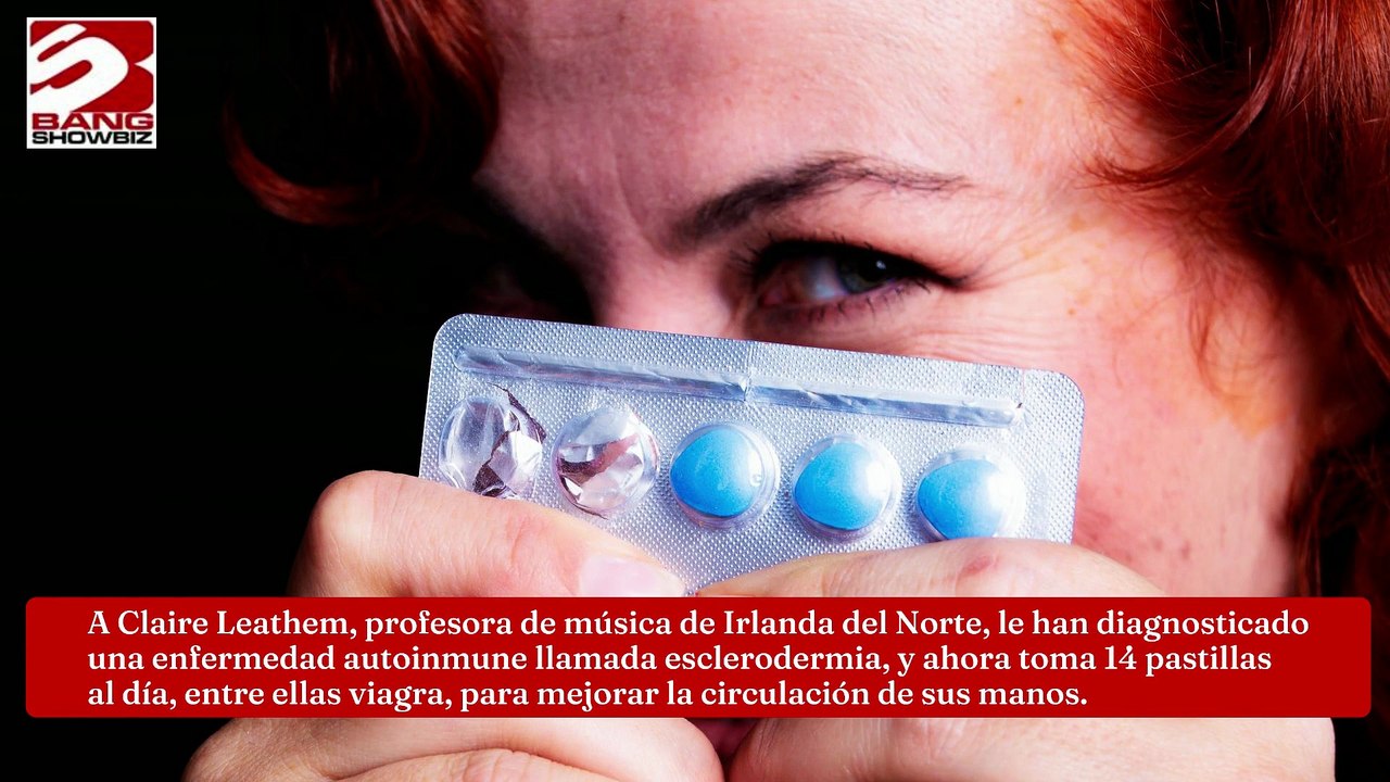 Mujer usa viagra para controlar los síntomas de la esclerodermia