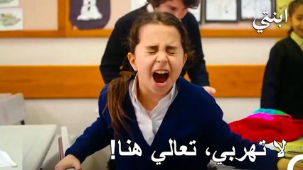 تساقط شعرها بسبب المرض - ابنتي