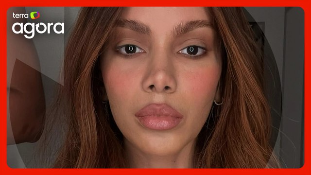 “Anitta pode fazer o que ela quiser com o corpo dela, a hora que ela quiser”, diz psicanalista.