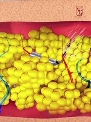 Chị từng rất tự ti vì bụng chảy xệ, giờ thì khác rồi… | Dr Nguyên Giáp