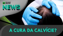 Cura da calvície: agora vai? | 11/07/2025