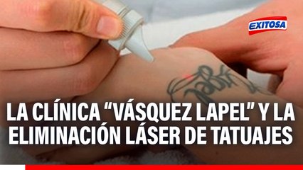 Clínica Vásquez Lapel te ofrece el tratamiento óptimo para eliminar tus tatuajes