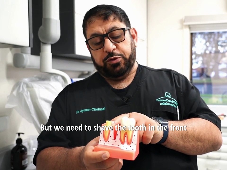 Dental Implants