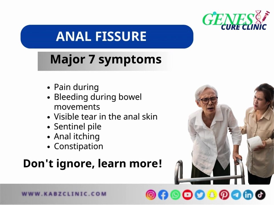 Anal Fissure: Causes, Symptoms, Treatment Options, and How Early Care Can Relieve Pain and Prevent Chronic Complications