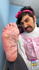 The Worst Moment? When Your Friend's Feet Stink! 🤢 #funny
