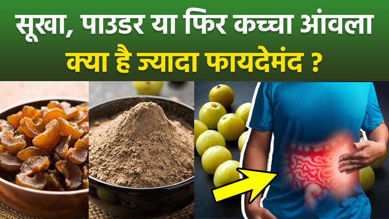Amla Benefits: सूखा, पाउडर या फ‍िर कच्चा आंवला, सेहत के लिए क्या है ज्यादा फायदेमंद | Boldsky