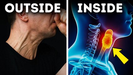 A Man Held In a Sneeze – Here’s Why You Shouldn't Do the Same