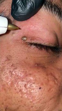 Skincare satisfying #1005