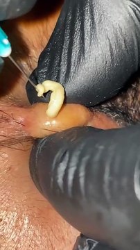 Skincare satisfying #1003