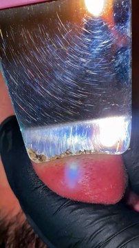 Skincare satisfying #1009