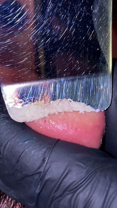 Skincare satisfying #1011