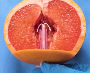 Medical Procedures Explained Simply