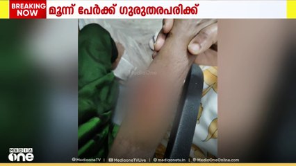 കോഴിക്കോട് പന്തീരങ്കാവ് മുതുവനത്തറയിൽ തെരുവുനായയുടെ ആക്രമണം; 3 പേർക്ക് ഗുരുതര പരിക്ക്