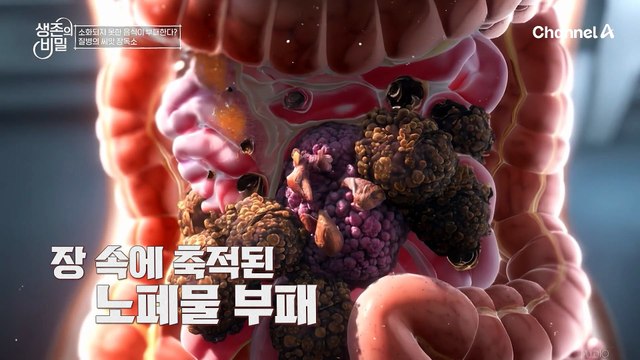 나는 왜 살이 찔까? 나이 들수록 사라지는 소화 효소! 뱃속 시한폭탄, 장 독소의 모든 것을 파헤친다!