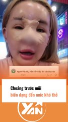 Choáng với MŨI BIỂN dạng đến mức khó thở