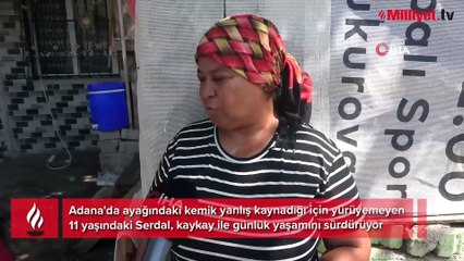 Hayatı 2 yaşındayken karardı, 9 senedir kaykayın üstünde yaşıyor! 'Ayağımın düzelmesini, okula gitmeyi çok isterim'
