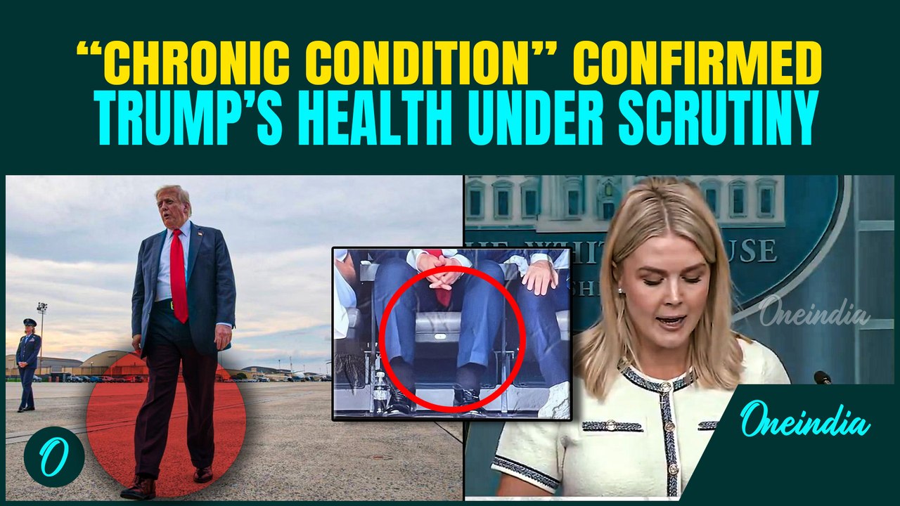 Trump Diagnosed with Chronic Venous Insufficiency Leg Swelling—Karoline Scrambles to Reassure Public