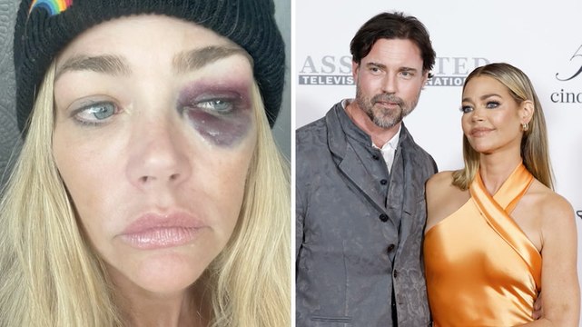 Denise Richards accuses ex Aaron Phypers of domestic violence, is granted temporary restraining order