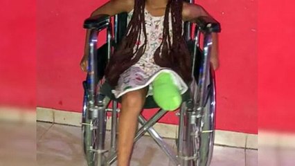 Niña pierde pierna tras ser atropellada por motorista en Bayona