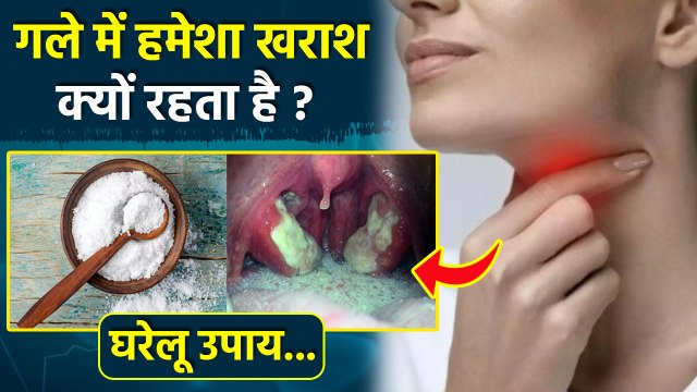 Sore Throat Causes: गले में हमेशा खराश क्यों रहता है,Treatment In Hindi | Boldsky