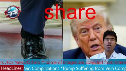 Trump Suffering from Vein Complications MHM NEWS