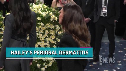 Hailey Bieber Shares Look at Her Perioral Dermatitis Flare Up _ E! News